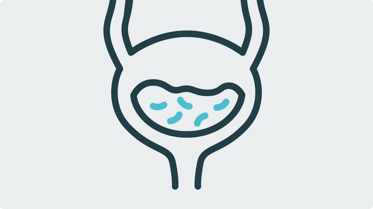 Lower urinary complication risk with IC versus indwelling catheters