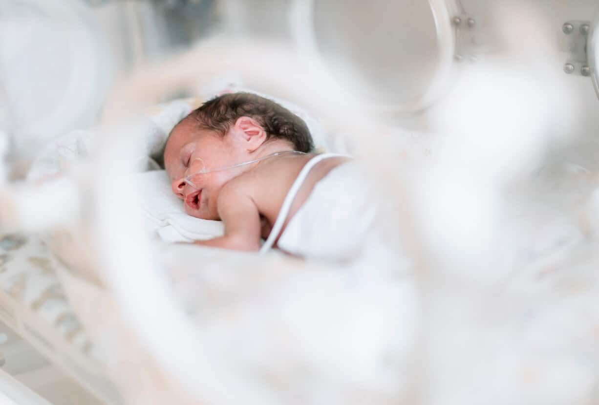 Easy to follow stoma care guidelines for babies 